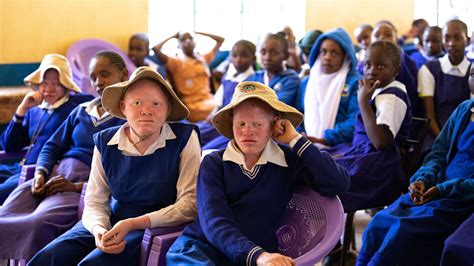 The Empowerment of Girls with Albinism: Shattering Stereotypes and Inspiring Others