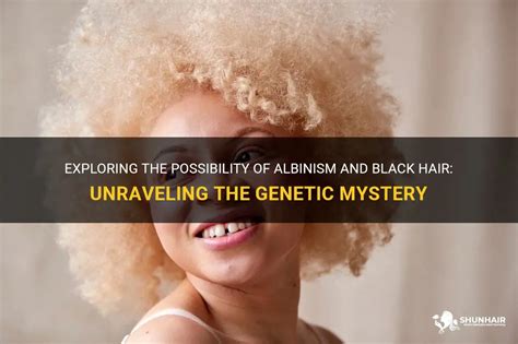 The Enigma of Albinism: Unraveling the Mystery