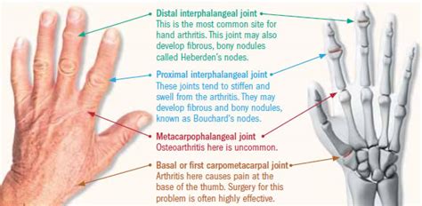 The Enigma of Finger Discomfort: Typical Signs and Root Causes