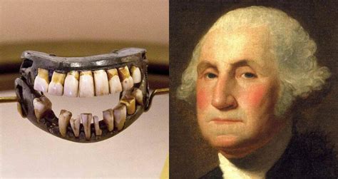 The Enigma of George Washington's Wood-like Dentures