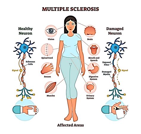 The Fascinating Life of Ms Muscle