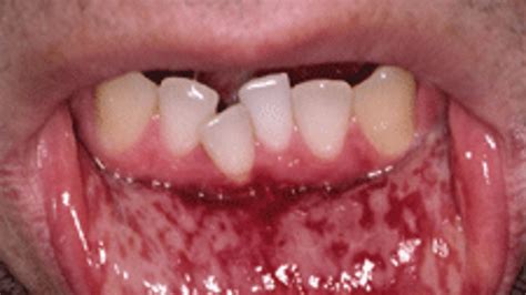 The Fascination of Oral Lesions