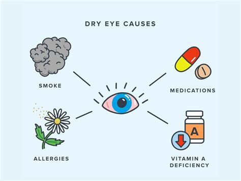 The Fundamentals of Dry Eye