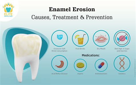 The Hidden Reasons for Lipstick Blemishes on Dental Enamel: Causes and Remedies