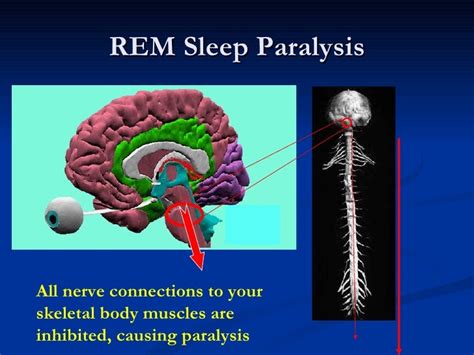 The Impact of Brain Chemistry on Paralysis during Sleep