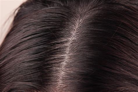 The Impact of an Unclean Scalp on Hair Health