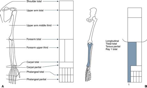 The Impact of the Absence of a Limb on Society