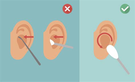 The Importance of Removing Earwax for Personal Hygiene