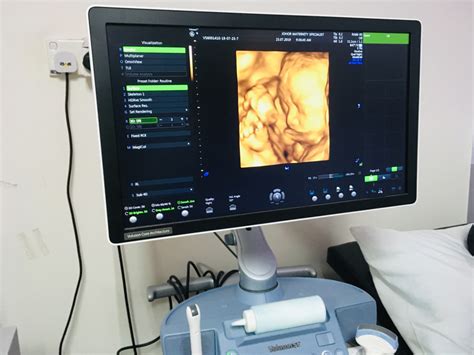 The Importance of Ultrasound in Monitoring the Progress of Fetal Development