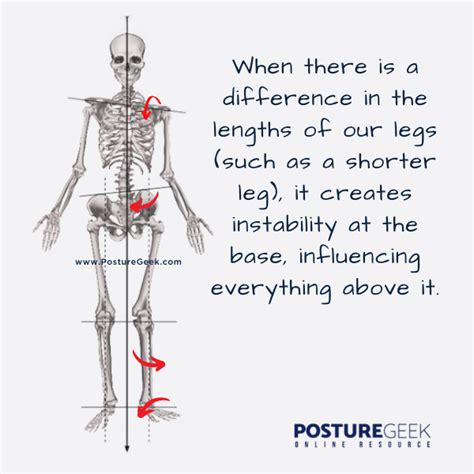 The Influence of Leg Length Discrepancy on Body Alignment and Walking Pattern