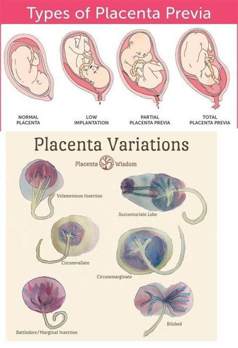 The Intricate Significance of Birthing Placenta in Dreams: Delving into its Deep Symbolism