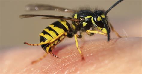 The Intricate Significance of Wasp Stings in the Realm of Dreams