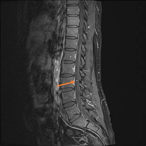 The Intriguing Imagery of a Back Growth