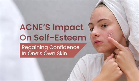 The Link between Acne-related Dreams and Self-confidence