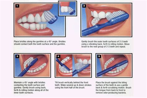 The Magic of Proper Brushing Techniques for an Enchanting Smile