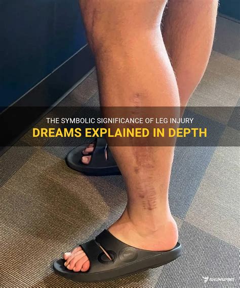 The Meaning Behind Dreaming of an Injured Limb: Exploring Symbolic Significance