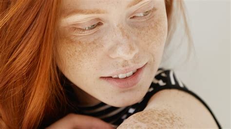 The Origin and History of Freckles