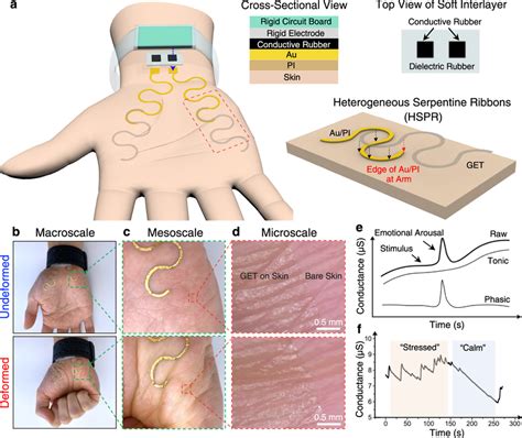 The Physical Interpretation of Dermis Stripping from Hands