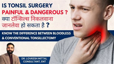 The Procedure: What to Expect During Tonsil Extraction Operation