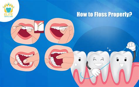 The Proper Technique for Effective Flossing