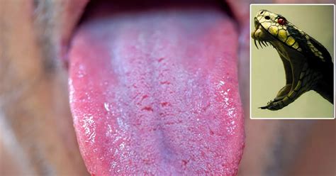 The Psychological Factors Behind Fantasizing About Tongue Amputation