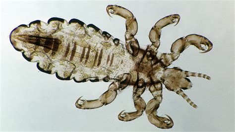 The Puzzle of Giant Lice: Discovering Their Evolutionary Journey and Remarkable Adaptations