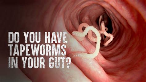 The Reality Check: Understanding the Consequences of Hosting a Tapeworm