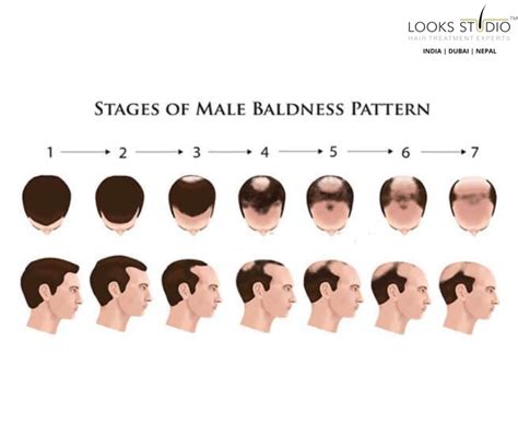 The Relationship between Hair and Identity: Analyzing the Impact of Baldness in Dreams