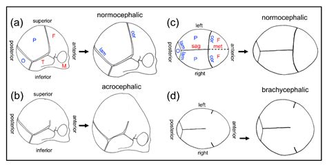 The Science behind Anomalies: Exploring the Possibility of a Dual Cranial Development