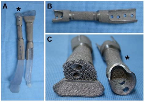 The Science of Integration: How Metal Implants Bind with Human Tissues