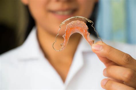 The Significance of Dental Retainers