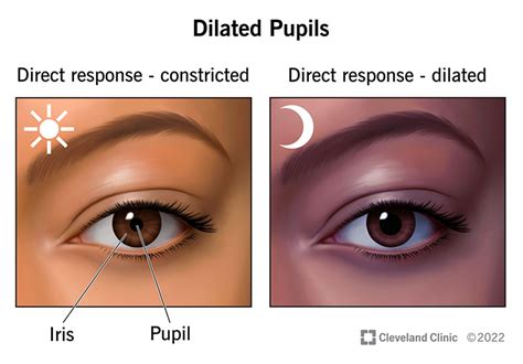 The Significance of Dilated Pupils in Dreams