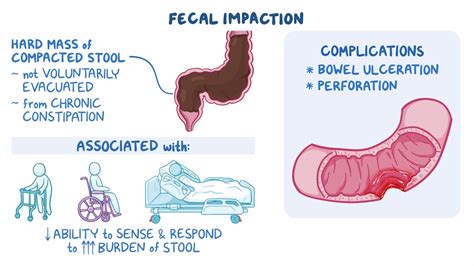 The Significance of Having a Fecal Vision in the Sleeping Sanctuary