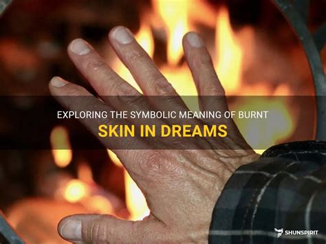 The Significance of Scorched Splints in Dream Interpretation