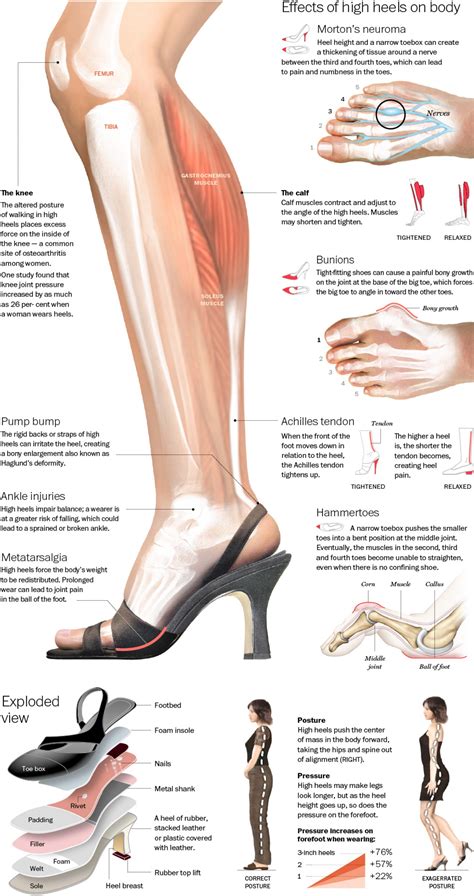 The Significance of a Damaged Heel in Nighttime Visions