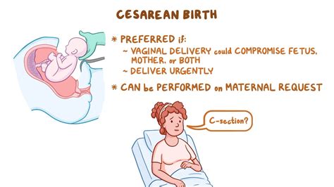 The Surge in Cesarean Deliveries: Comprehending the Upward Pattern