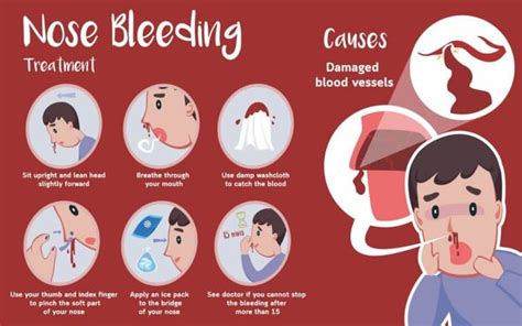 The Symbolic Meaning of Epistaxis in Diverse Cultures