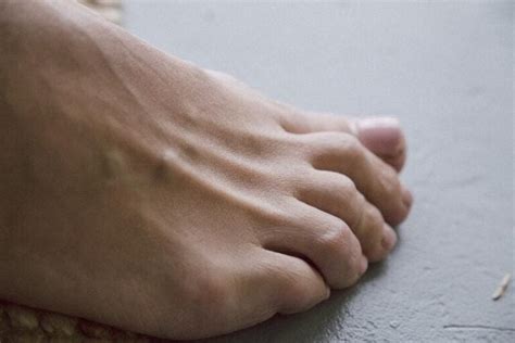 The Symbolic Meaning of a Dream about Losing a Toe