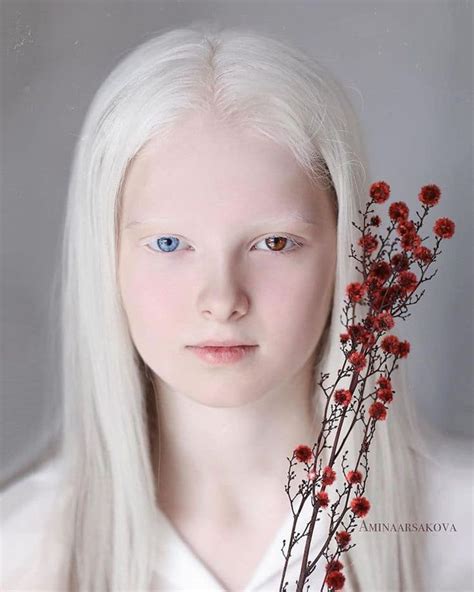 The Symbolic Representation of Albino Girls in Art and Literature