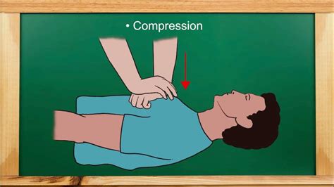 The Symbolic Significance of Cardiopulmonary Resuscitation (CPR) in Dreams