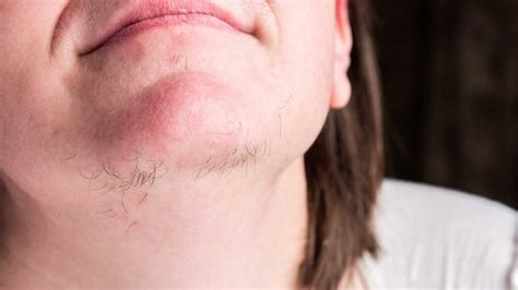 The Symbolic Significance of the Chin and its Hair