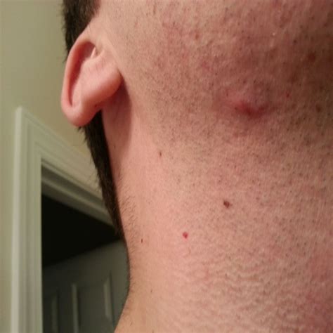 The Temptation of Adorning the Neck: The Reasons behind Choosing this Spot