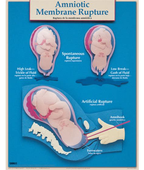 The Timing: When Can Your Amniotic Membrane Rupture?