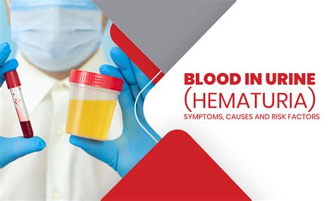 The Underlying Causes and Potential Risk Factors of Hematuria