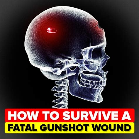 The enigma surrounding dreams of surviving a fatal shot to the head