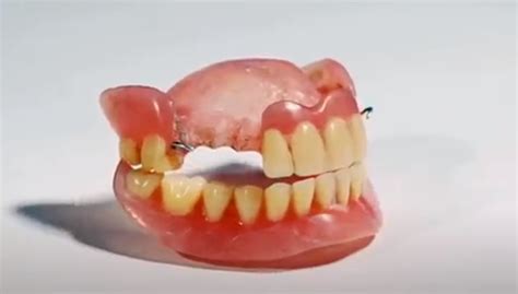 The potential consequences of neglecting timely repair of a damaged orthodontic appliance