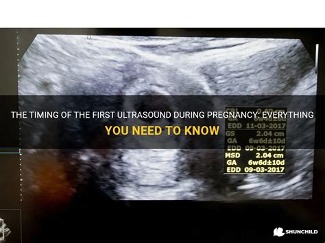 Timing Your First Ultrasound: Determining the Right Moment for Your Initial Examination