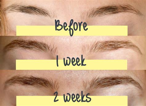 Tips for Cultivating and Maintaining Healthy Brow Growth