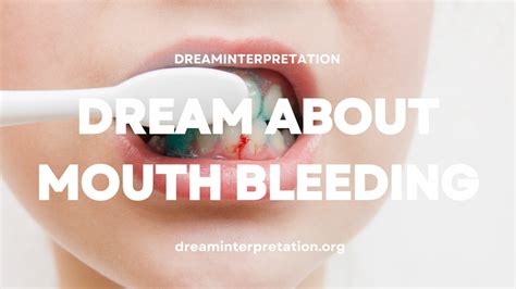 Tips for Dealing with Dreams Involving Oral Bleeding