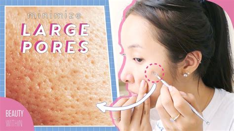 Tips for Safely Removing Large Clogged Pores